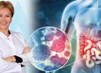 Kolon Kanseri Önlenmesi: Kolonoskopi Hakkında Prof. Dr. Arzu Tiftikçi Açıklaması kolon-kanseri-nlenmesi-kolonoskopi-hakknda-prof-dr-arzu-tiftiki-aklamas