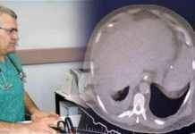 Sigara Kalp Sağlığının En Büyük Düşmanıdır – Dr. İsmail Erdoğu sigara-kalp-salnn-en-byk-dmandr-dr-ismail-erdou