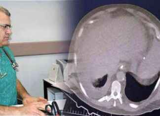 Sigara Kalp Sağlığının En Büyük Düşmanıdır – Dr. İsmail Erdoğu sigara-kalp-salnn-en-byk-dmandr-dr-ismail-erdou